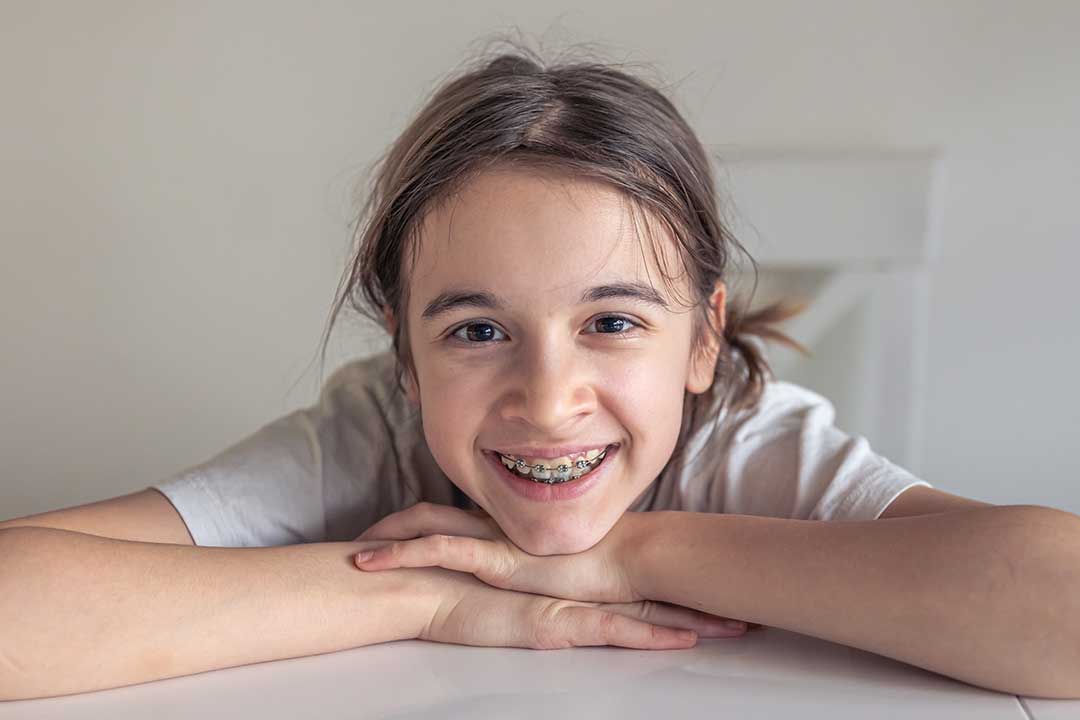 5 Common Questions About Orthodontics for Children