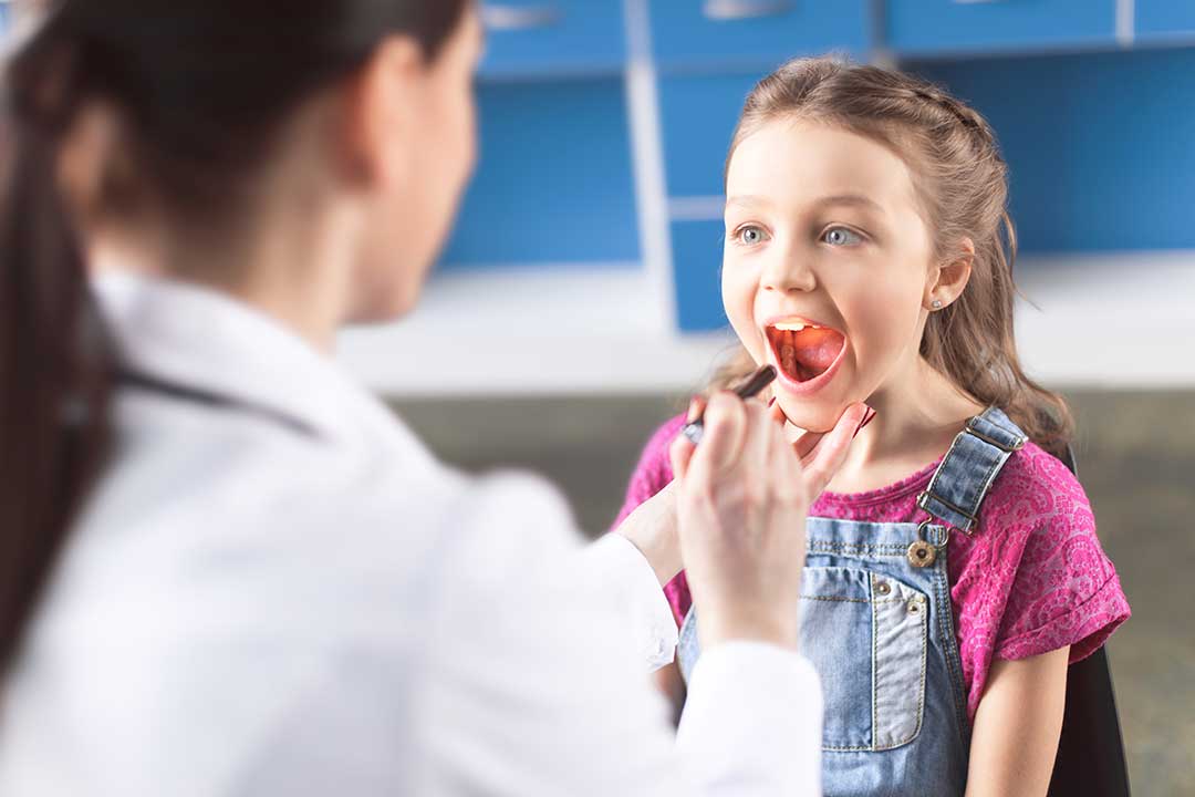 How Enlarged Tonsils Affect Breathing, Swallowing, and Jaw Growth